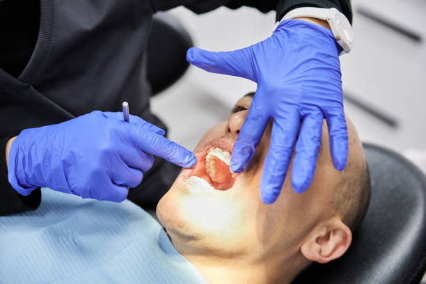 Best Knocked-Out Tooth (Avulsed Tooth) Treatment in West Haven, UT
